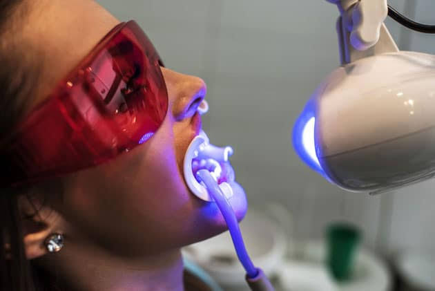 Professional dental whitening